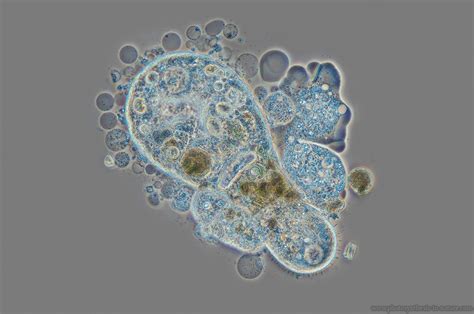  Opercularia! A Tiny Amoeba With a Microscopic House