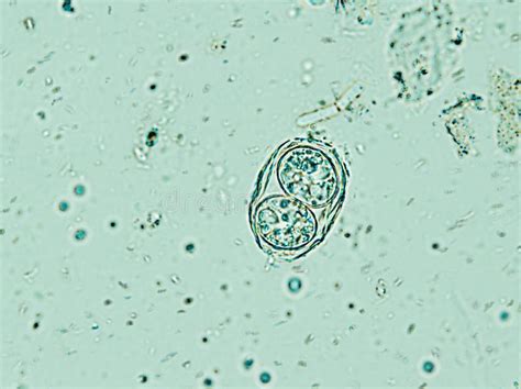  Toxoplasma Gondii: Una entidad microscópica que puede transformar el comportamiento de sus huéspedes