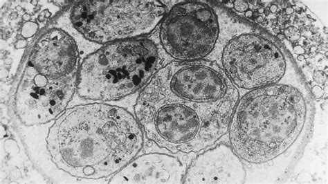  Toxoplasma gondii: Un huésped silencioso que manipula mentes y desafía la lógica evolutiva