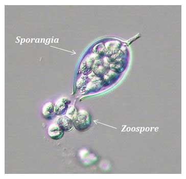  Zoosporangium: ¡Una explosión de esporas microscópicas que te dejarán boquiabierto!